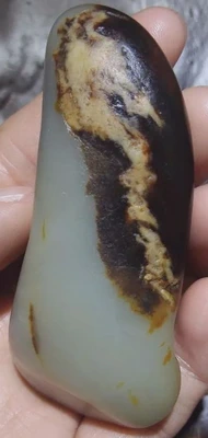 真皮 僵斑 真皮 僵斑